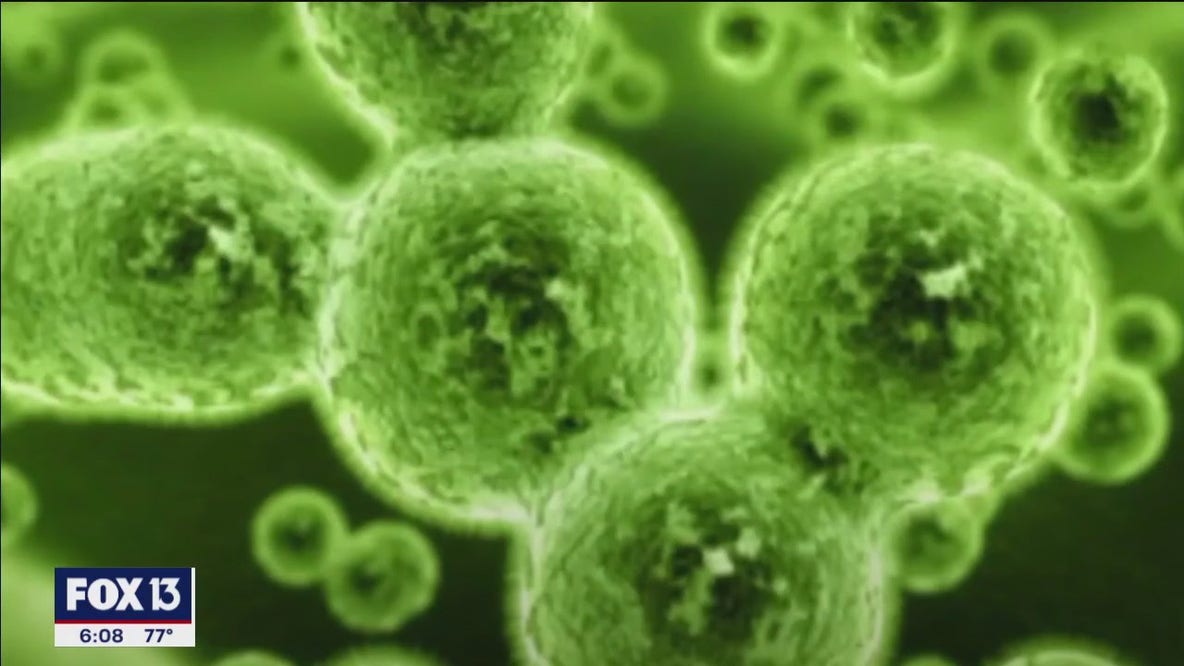 Bay area doctors see rise in norovirus cases